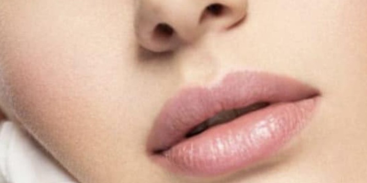 Russian Lips –  präzise Lippenmodellierung