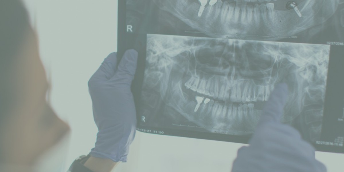 Professional Cleaning & Gum Care at Pinner Dent