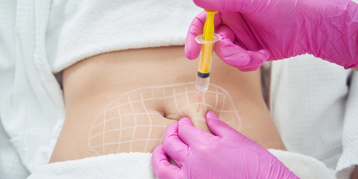 Patient Reviews: Fat Melting Injections