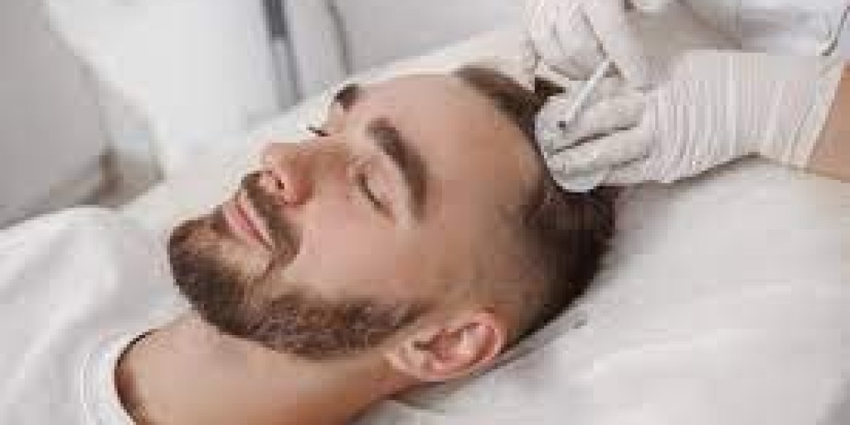 Afro Hair Transplant Turkey – A Global Standard