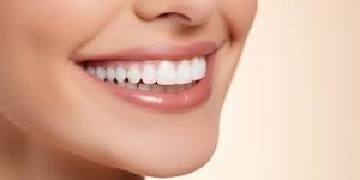 How to Maintain Your White Smile After Teeth