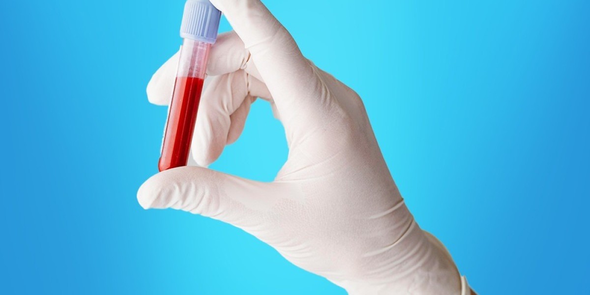When Is Ideal for a Home Blood Test in Dubai?