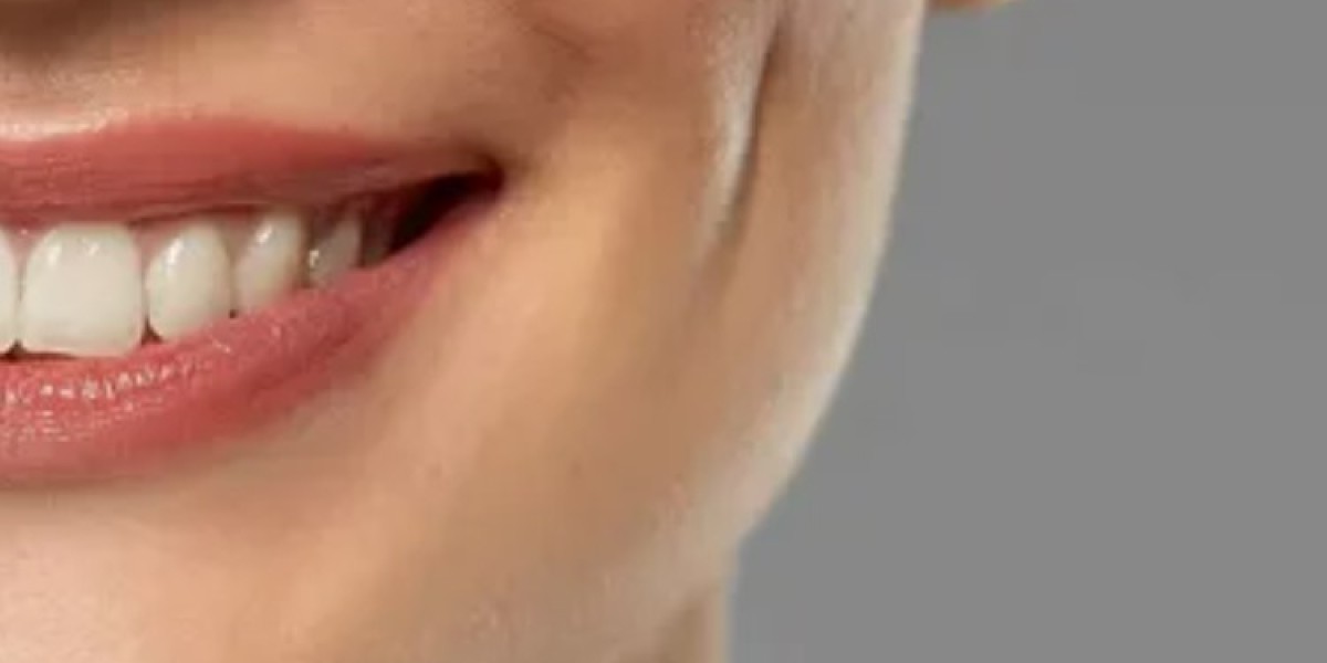 Role of facial anatomy in dimple creation