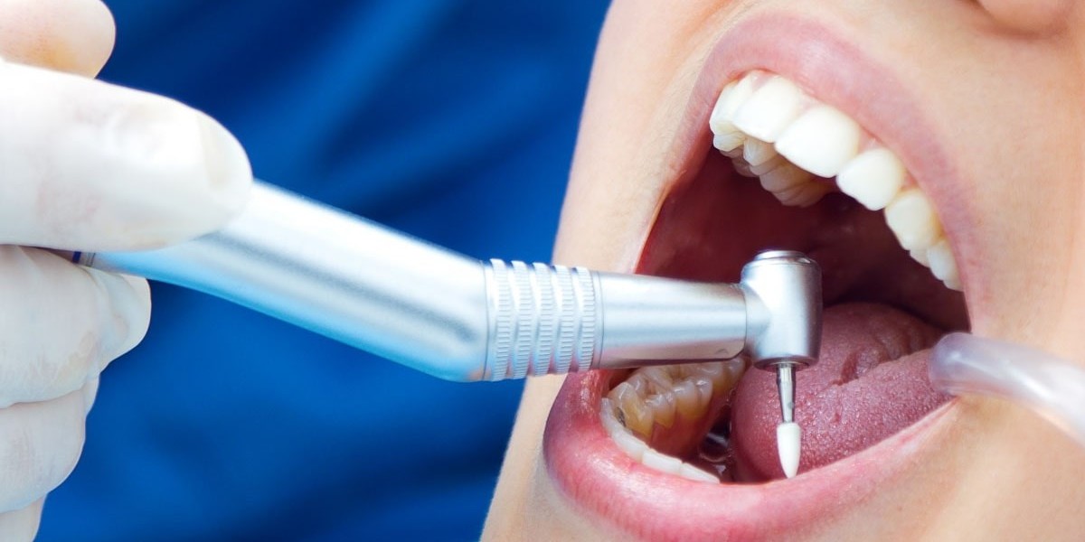Tooth Filling Cost: Everything You Should Know