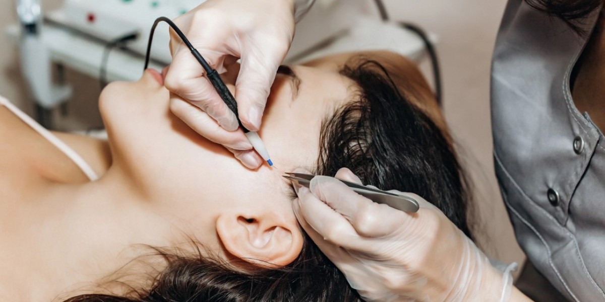 Pain Management During Laser Hair Removal