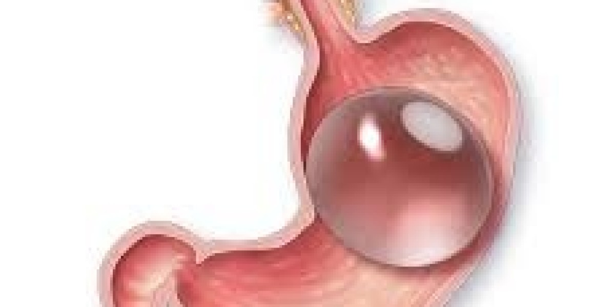 Can a gastric balloon improve my mental health