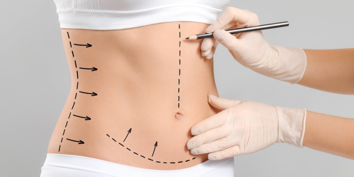 Cost Factors for Tummy Tuck in Islamabad