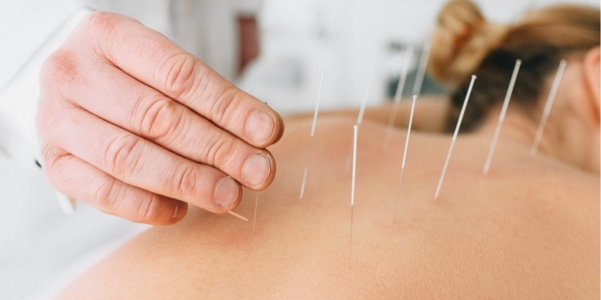 Dry Needling NYC