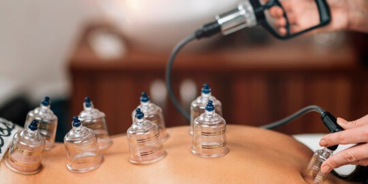 Everything You Need to Know About Wet Cupping