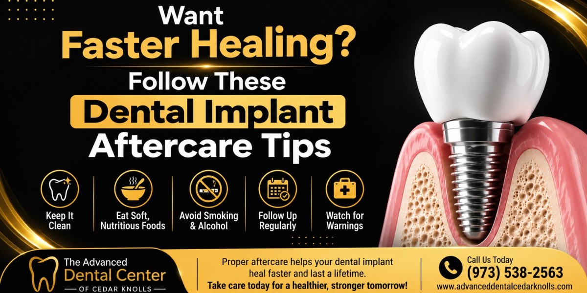 Which Option Is Right for Your Smile? Veneers