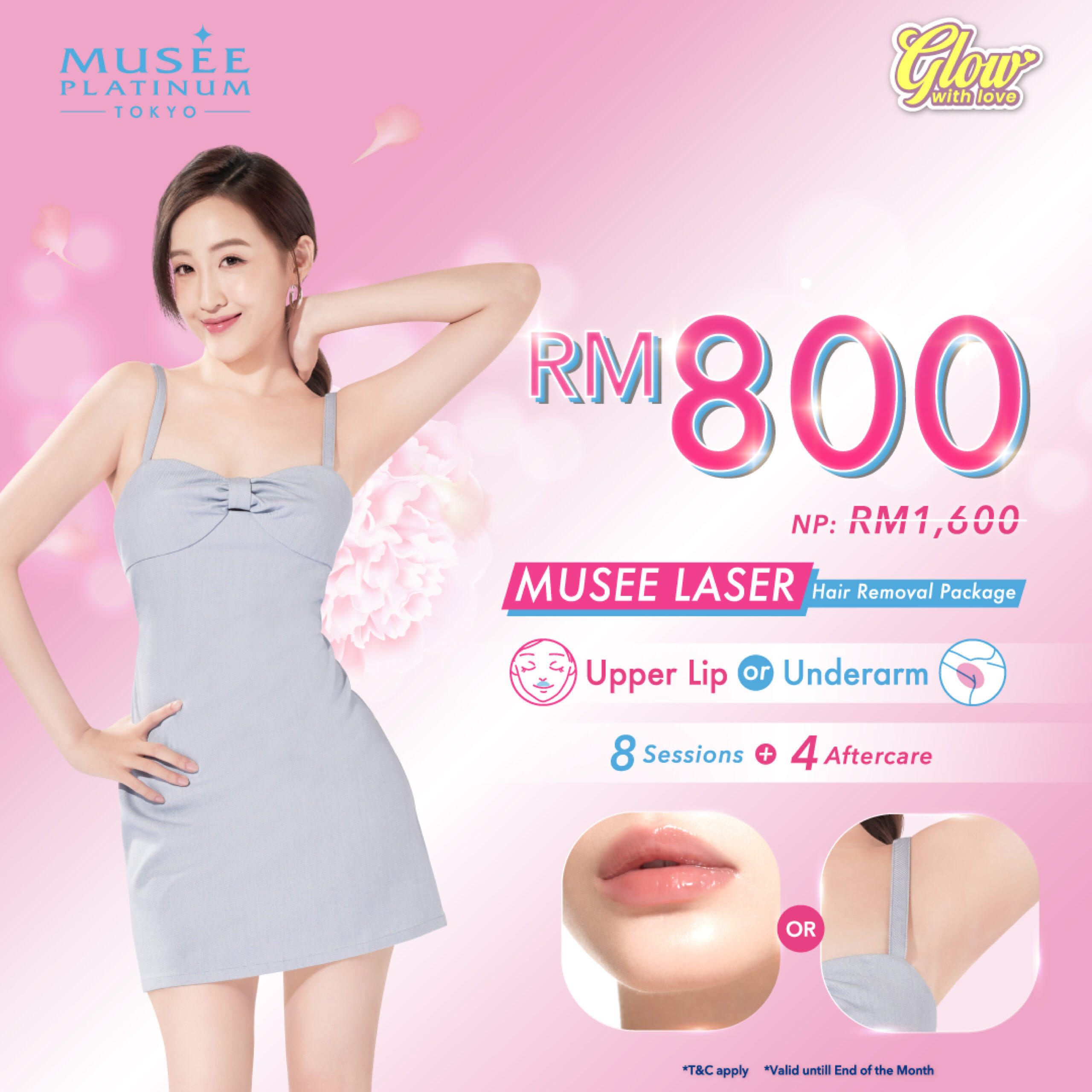 Musee Laser Hair Removal Package | 8+4 Sessions - Musee