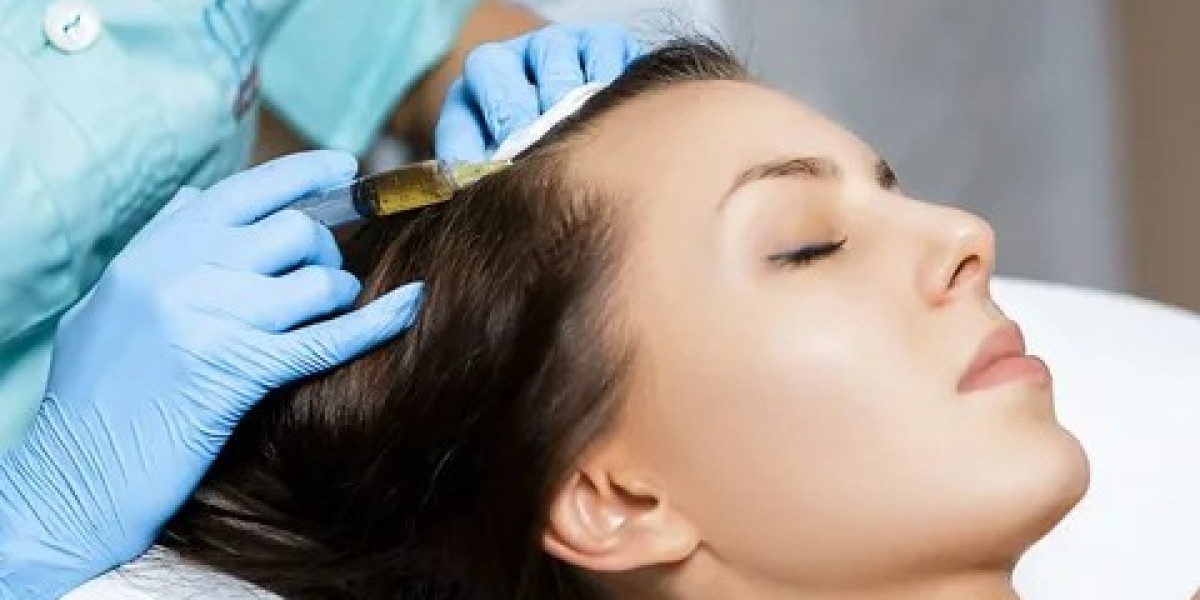 PRP Hair Treatment in Dubai:Restore Volume Safe