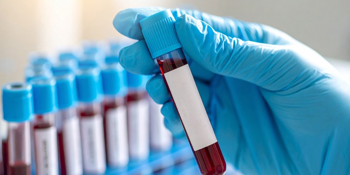 Vitamin D Test Price: Cost, Results & Procedure