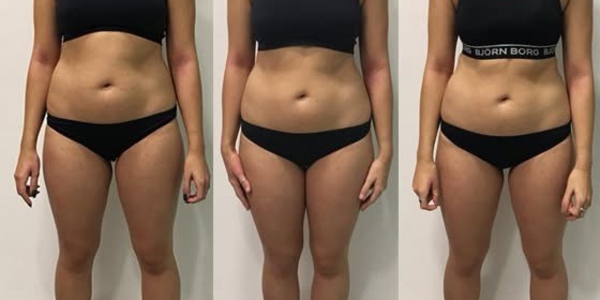 Retafit Germany