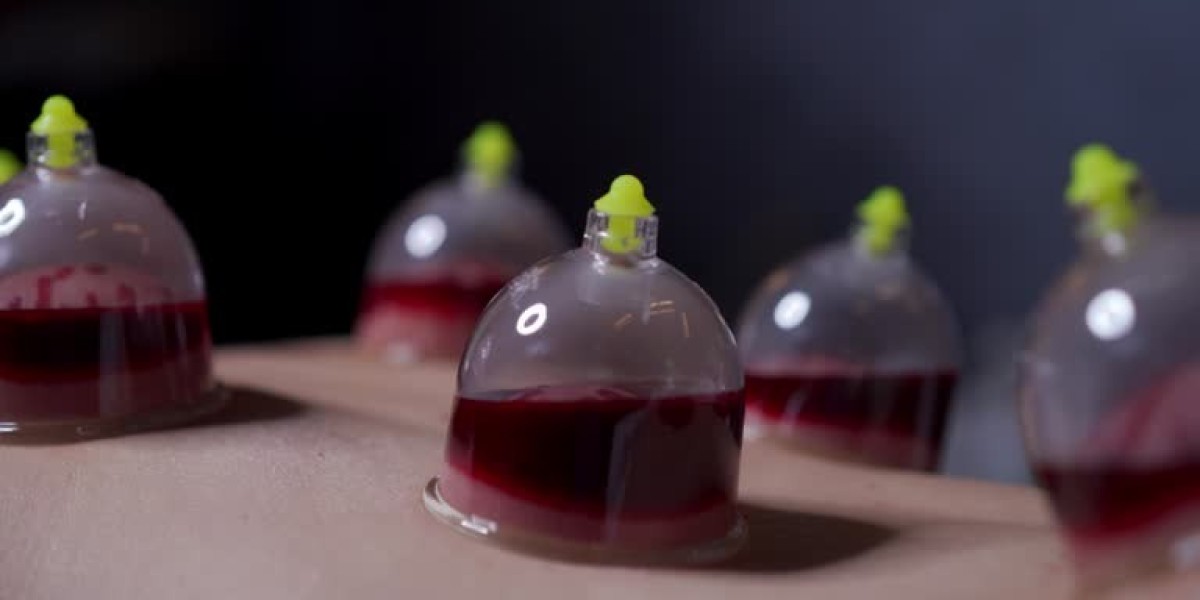 What to Know Before Getting Wet Cupping