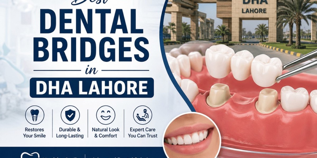 Best Dental Bridges in DHA Lahore