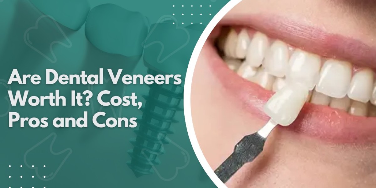 How Porcelain Veneers Support Improving Smile