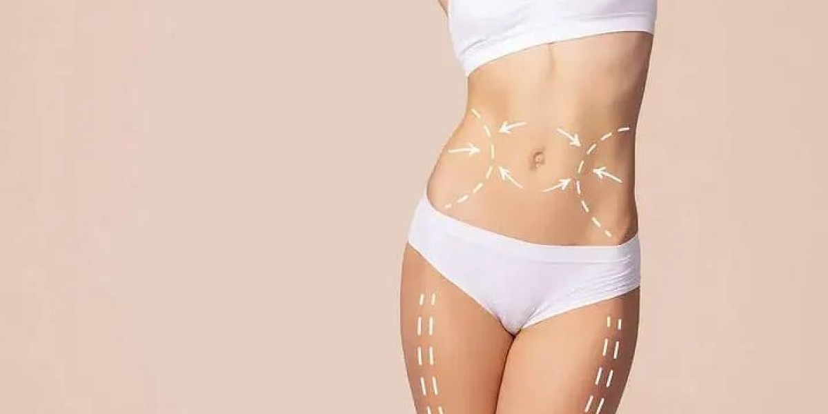 Liposuction in Dubai: Achieve Your Ideal body