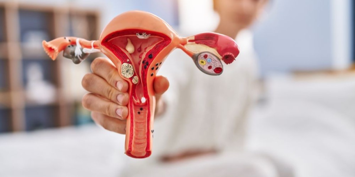 Uterine Fibroid Treatment Market Scenario