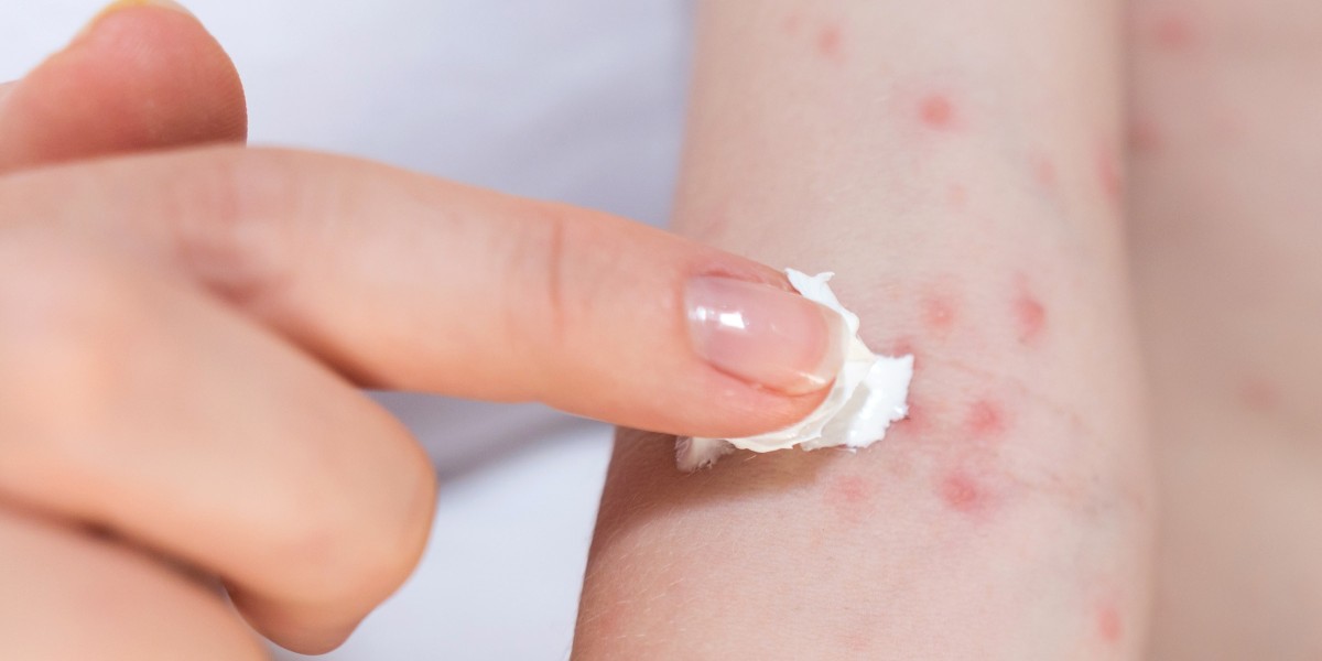 Best Skin Doctor in North East