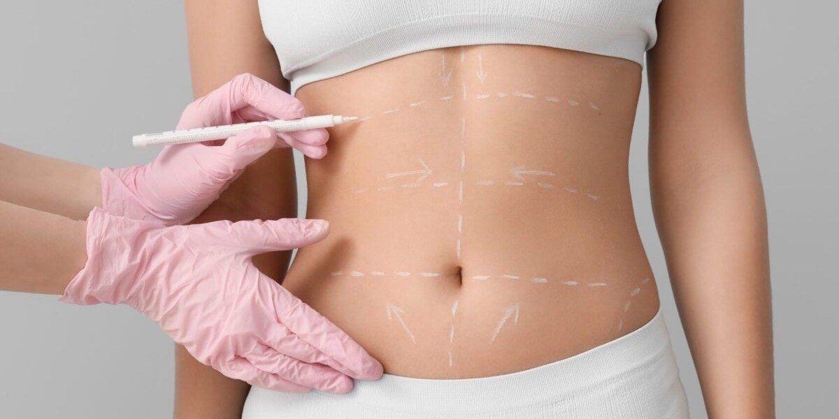 Tummy Tuck in Dubai: Professional  Makeover
