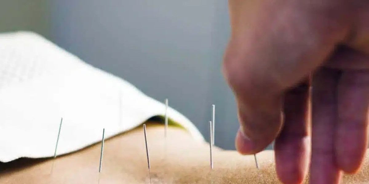 Midtown Acupuncture