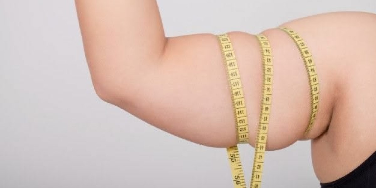 Arm Lift Surgery in Dubai: Refining Your body