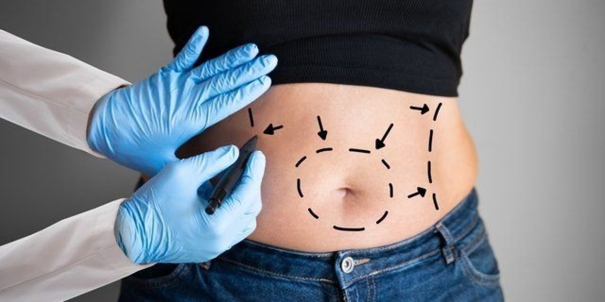 Mini Abdominoplasty in Dubai: Flatter Tummy
