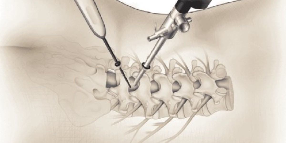 Endoscopic Spine Surgery Al Ain: Treatment and
