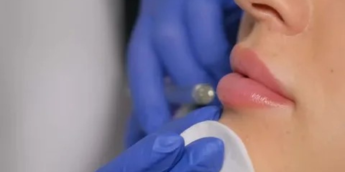 Fillers in Dubai: Best Clinical Approaches