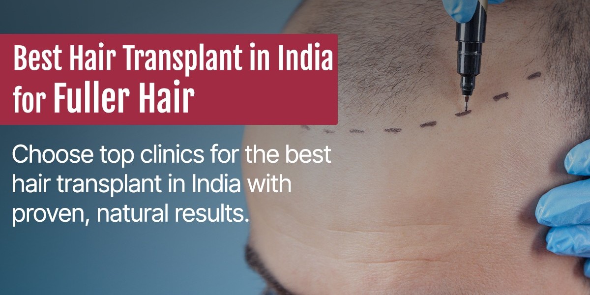 Best Hair Transplant in India: A Complete Guide