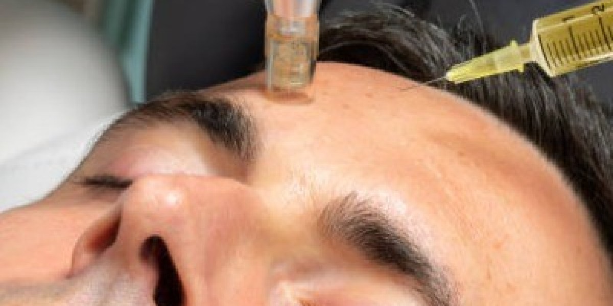 Could Microneedling With PRP Help Improve Your