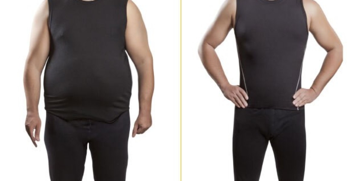 Hair Loss After Bariatric Surgery: Causes and P