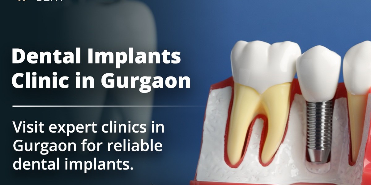 Dental Implants Cost in Gurgaon: What You Shoul