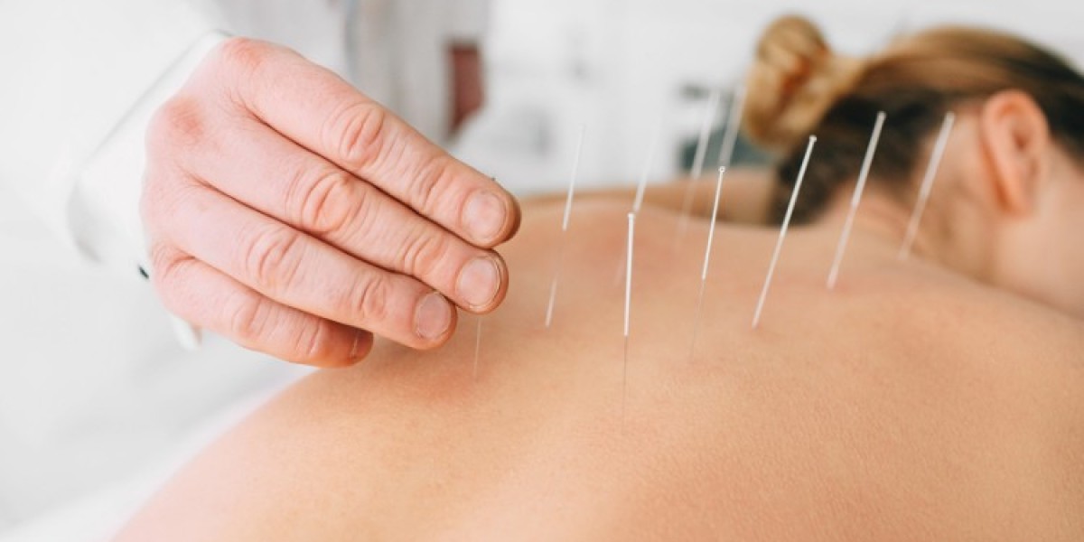 Acupuncture Billing Issues That Delay Payments