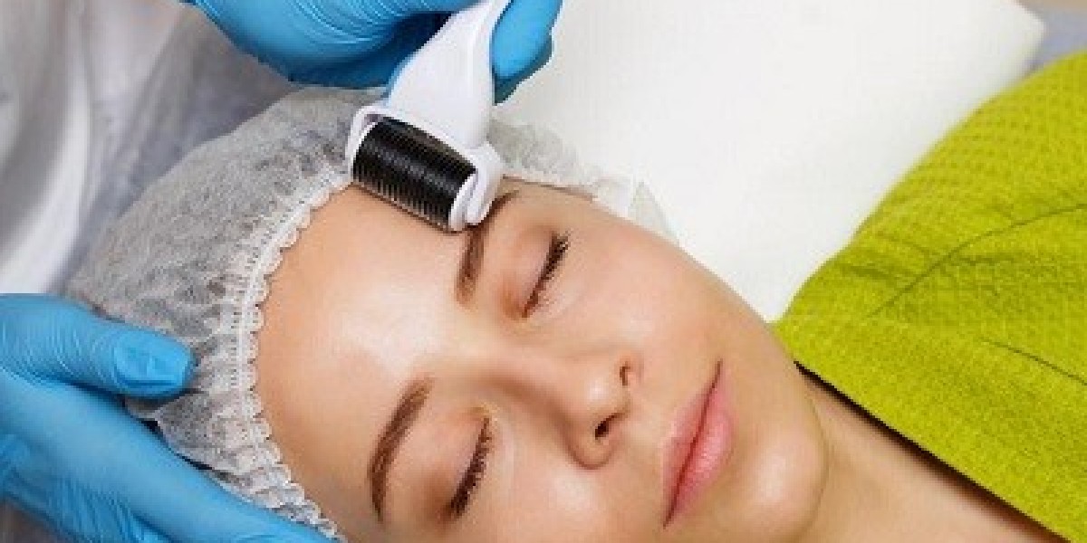 What Are the Benefits of Derma Roller Treatment
