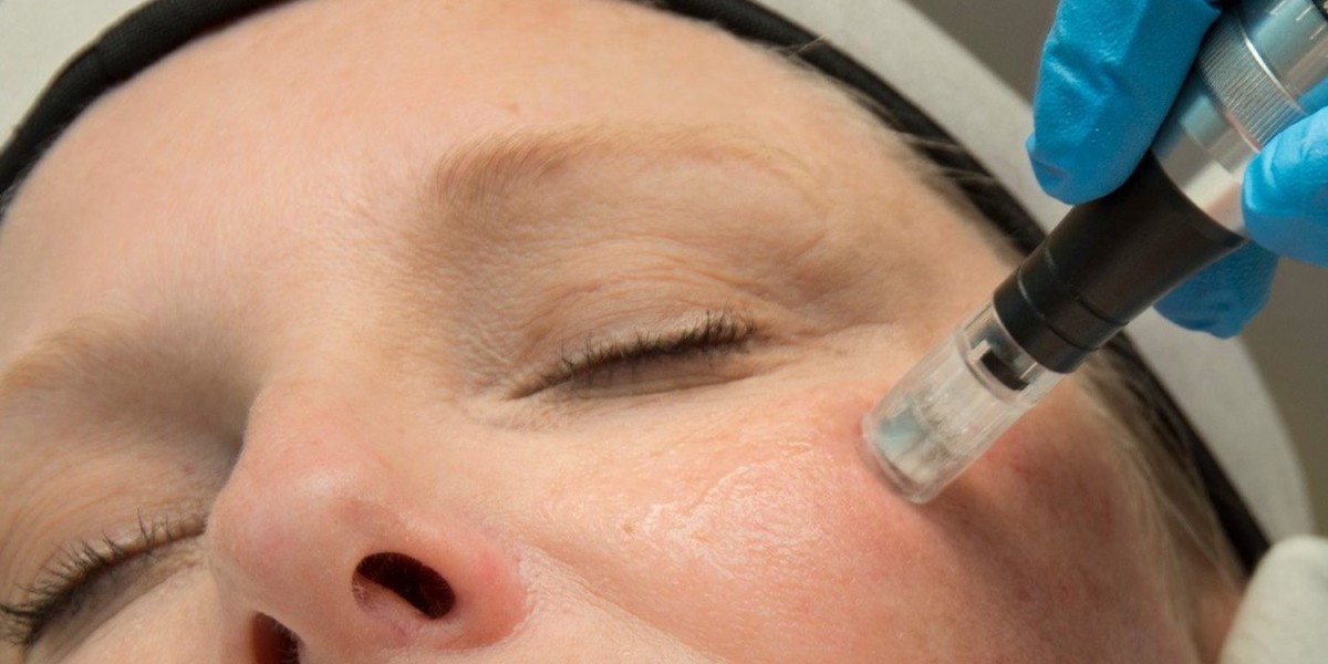 Skin Rejuvenation in Kalispell: Restore Your Na