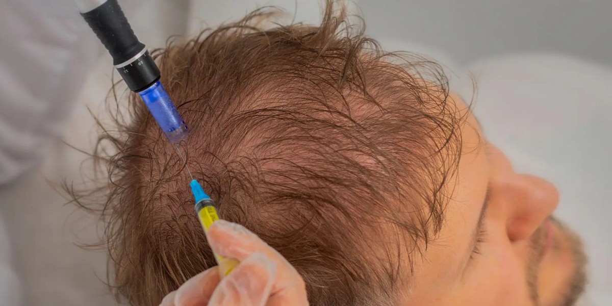 Exosome Therapy for Hair Thinning: Benefits and