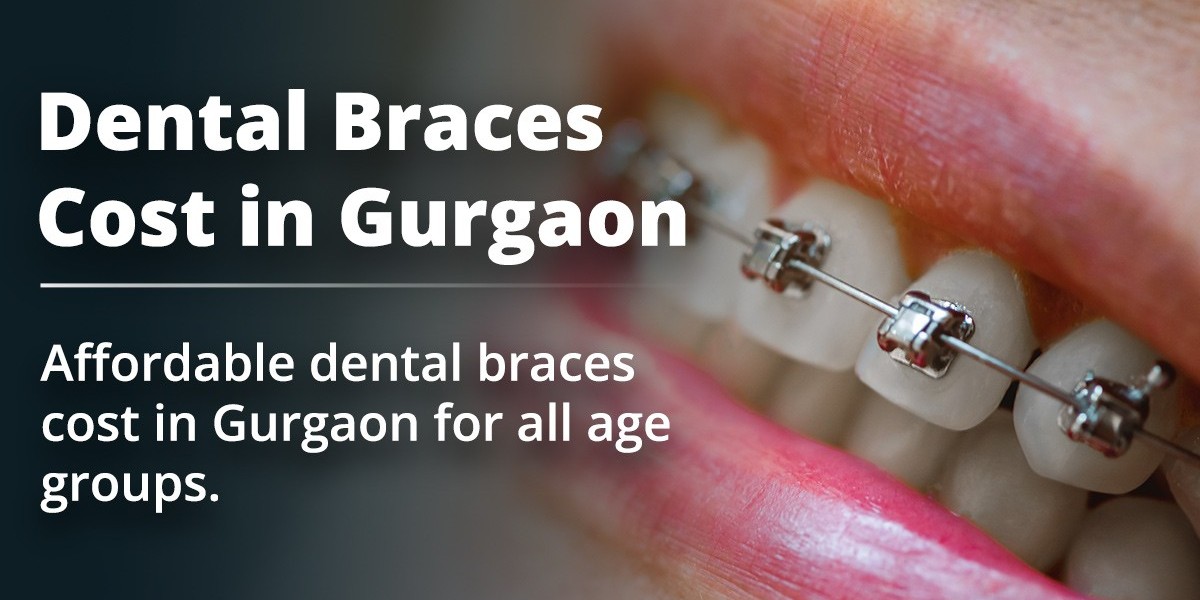 Complete Guide to Dental Braces Cost in Gurgaon