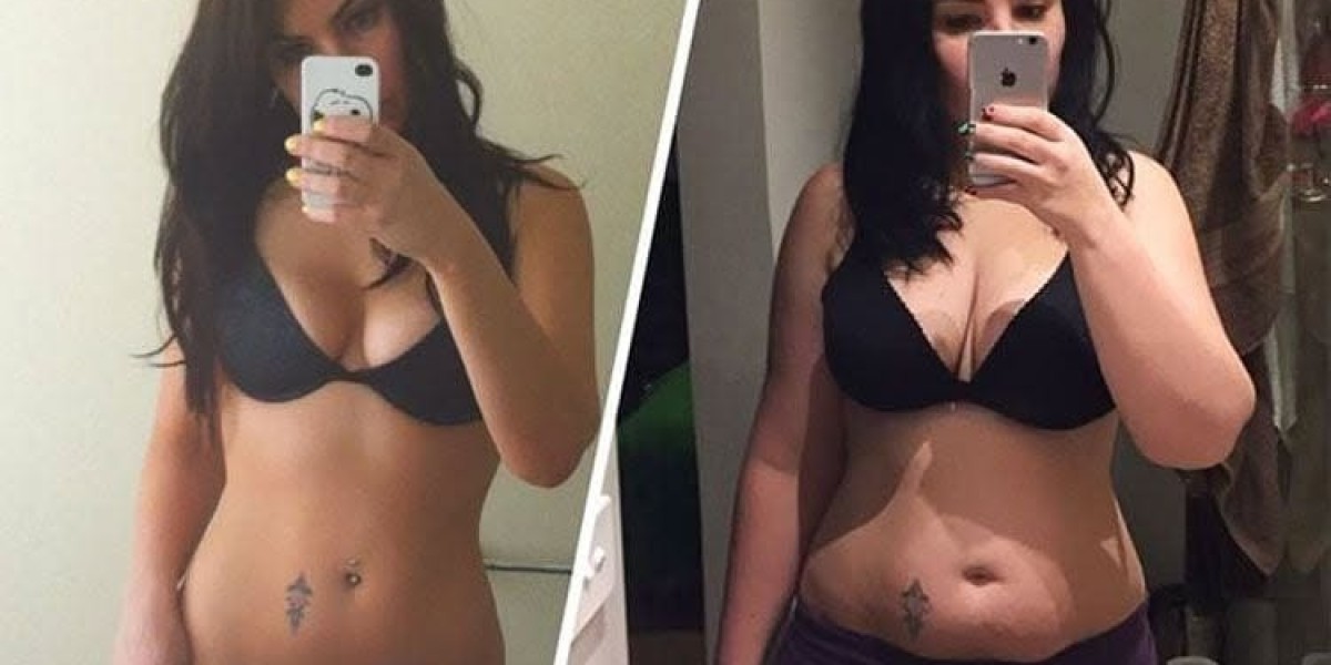 LipoLyX Plus UK Keto